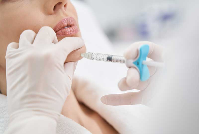 A woman getting a dermal filler injection in her chin