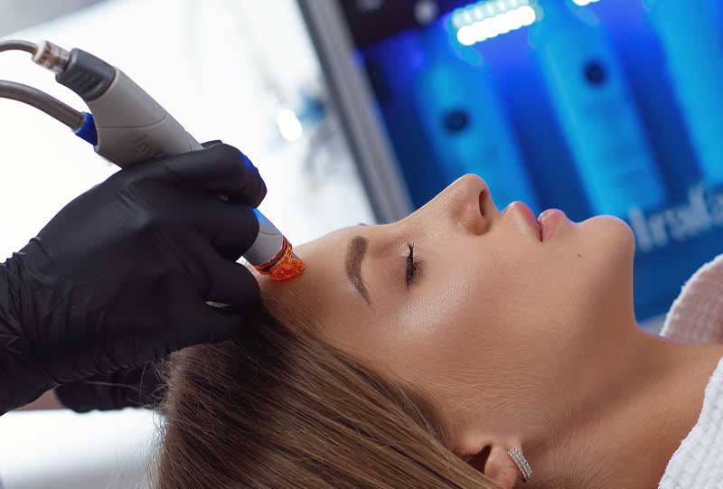 woman getting a hydrafacial