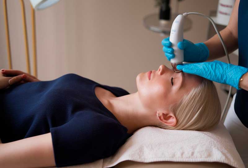 woman getting microneedling treatment